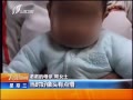 7š 4´Ӥβ