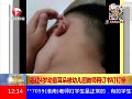 Ƶ4ͯ䱻׶԰ʦö鶤