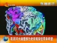 ӱ 3DͼΪմ֢ϣ