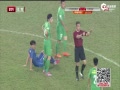 Ƶ¼-2015г11 VS°볡