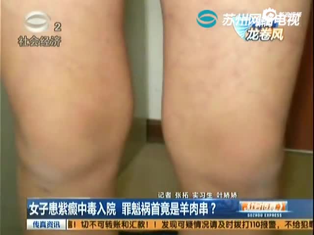 女子吃羊肉串全身紫癜
