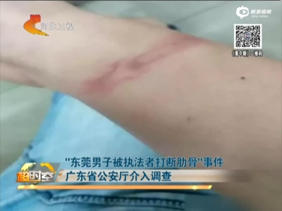 “东莞男子被执法者打断肋骨”事件  广东省公安厅介入调查