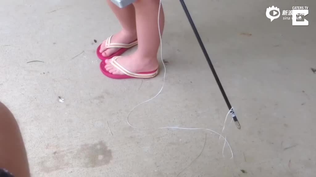 勇气可嘉：5岁小女孩用弓箭给自己拔牙