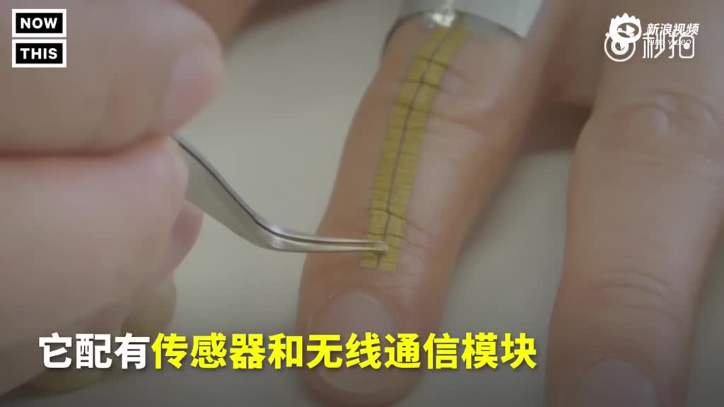 日本发明“电子皮肤” 贴在手上监测人体健康