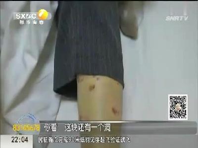 杨凌75岁老太误入工地 被4条大型恶犬严重咬伤头皮大面积撕裂
