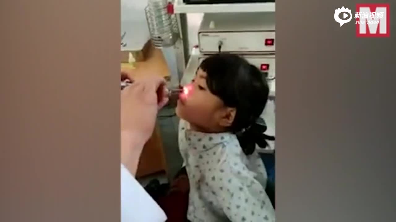 视频-越南小女孩鼻子藏异物近1月 医生取出7.6