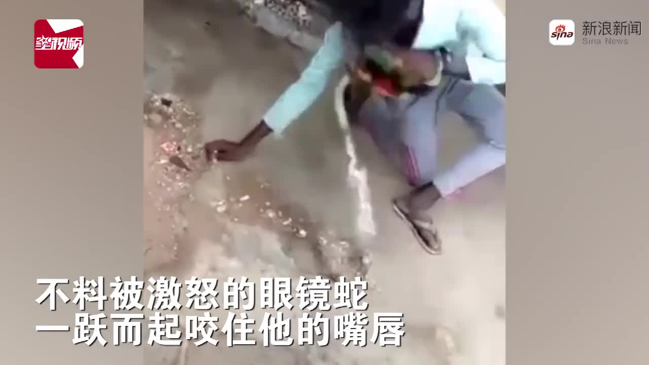 视频：印度男子模仿网络视频亲吻眼镜蛇 被咬成香肠