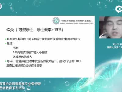 肺结节临床管理策略