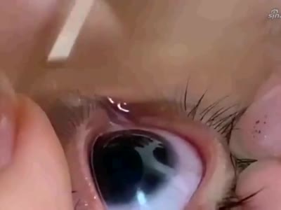 每天看手机的我们,眼睛里究竟有多少脏东西