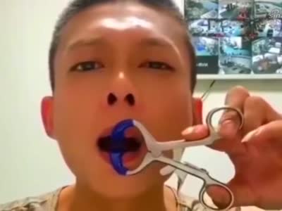 槟榔吃多了的下场,严重的要割掉半边脸,现在喝口水都是一种奢侈