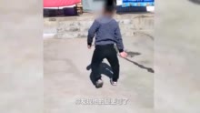 关注罕见病！幼儿身材矮小警惕低磷性佝偻症 低磷性佝偻症患者年用药费用超百万