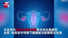 33岁男子长期腹痛一查染色体竟是女性，动手术切除子宫卵巢