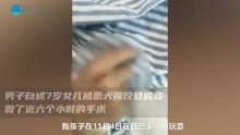 男子自述7岁女儿被恶犬撕咬致毁容：做了近六个小时手术