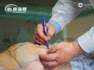 视频：女子天生胸大屡遭性骚扰 已做缩胸手术