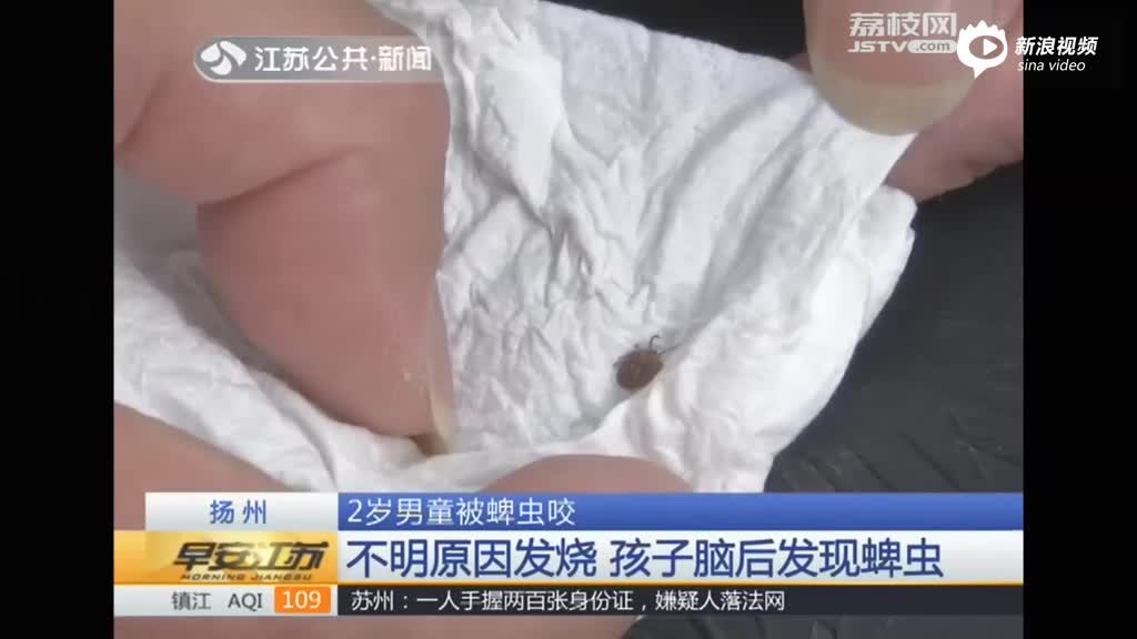 扬州2岁男童被蜱虫咬 孩子脑后发现蜱虫