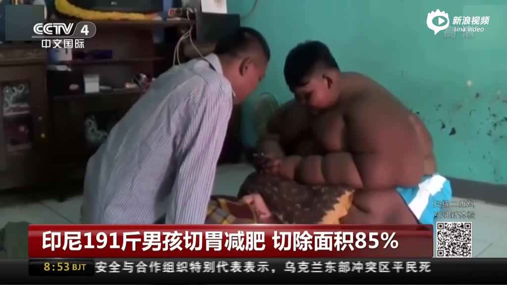 印尼191斤男孩切胃减肥 切除面积85%