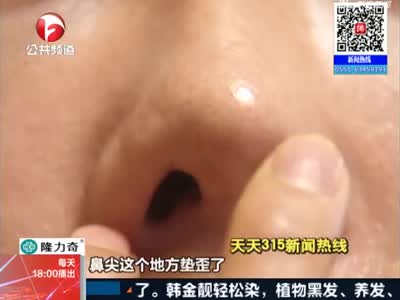 《新闻第一线》阜阳：女子整形去隆鼻  术后鼻孔大小不一