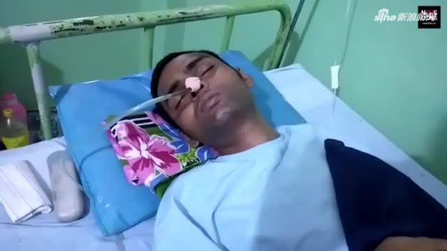 视频：印度一男子腹痛 医生从其腹中取出30余件利