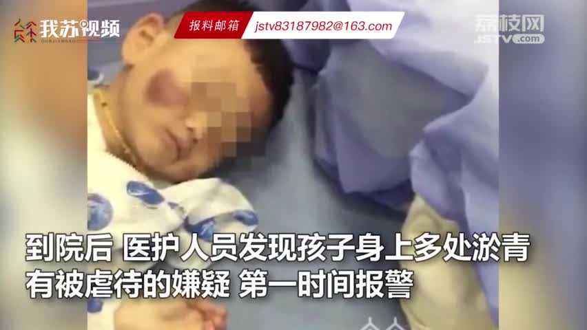视频-2岁男童遭生父后妈虐打 抢救半月余离世