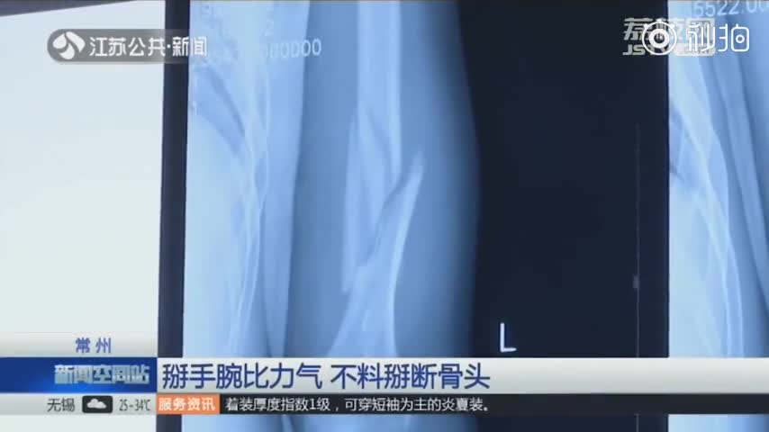 视频：看着都疼！21岁小伙掰手腕掰断了骨头