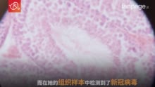 最新发现：意大利一女子2019年11月已感染新冠