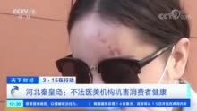 秦皇岛一不法美容机构不具备医疗整形资质 导致女子眼睛一大一小