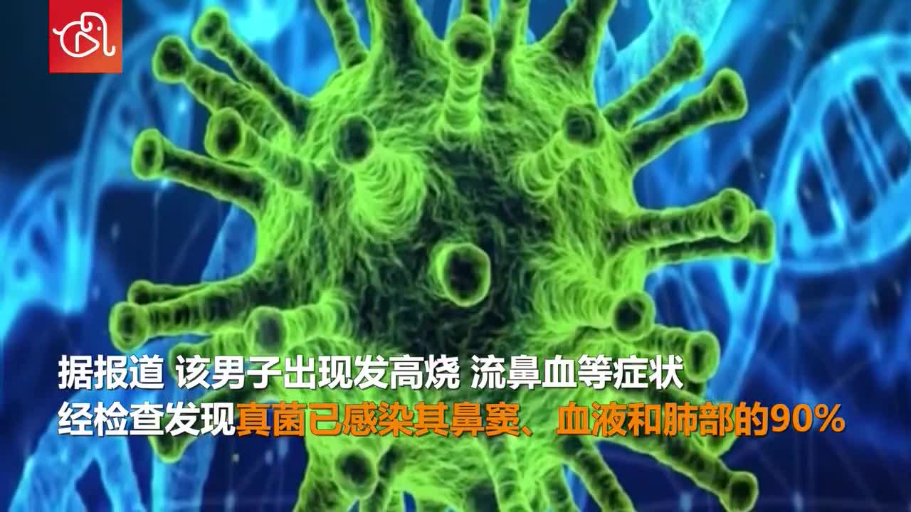 继黑 白 黄真菌后印度又发现首例绿真菌症病例 新浪科技 新浪网