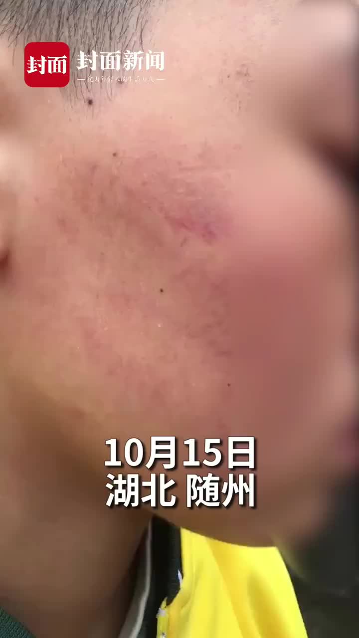 课间打闹碰到别的班级教室门湖北随州一初中生被老师